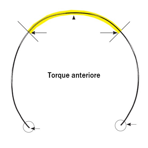 NICHEL TITANIO SUPER-ELASTICO PRE-TORQUE CURVA-SPEE